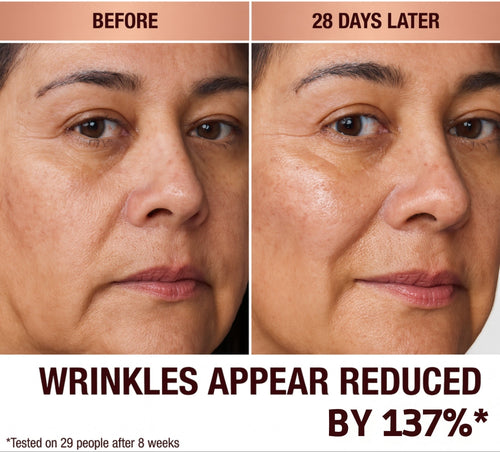 Orvani Calcium Multi Balm - Wrinkles, Dark Spots, Sagging, Aging