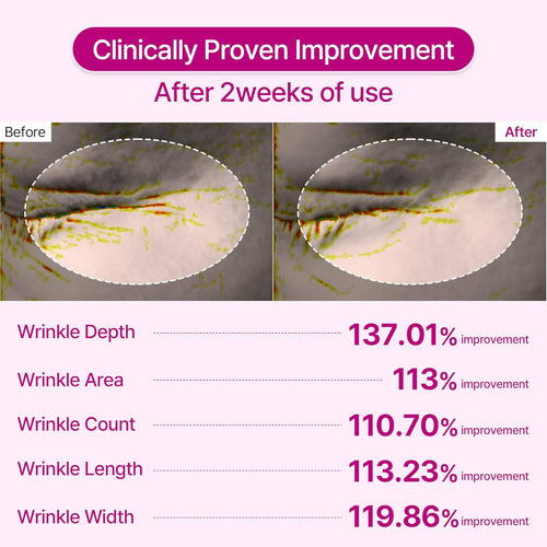 Orvani Calcium Multi Balm - Wrinkles, Dark Spots, Sagging, Aging