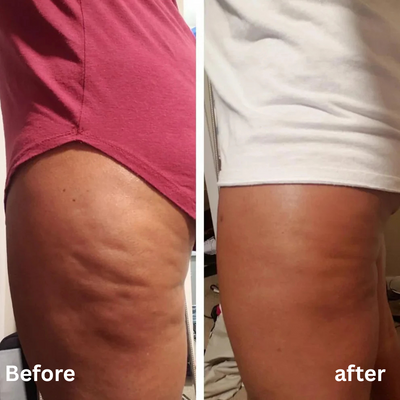 Anti-Cellulite Massage Oil