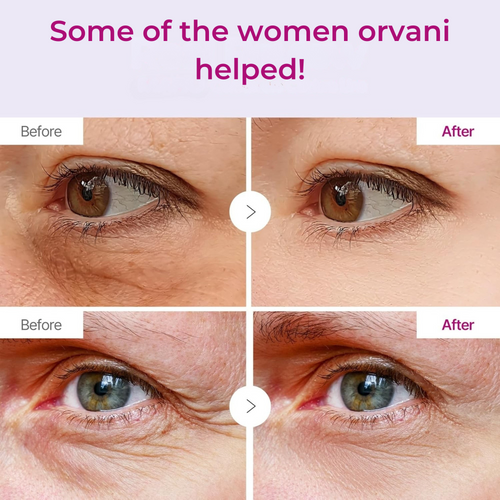 Orvani Calcium Multi Balm - Wrinkles, Dark Spots, Sagging, Aging