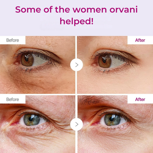 Orvani Calcium Multi Balm - Wrinkles, Dark Spots, Sagging, Aging